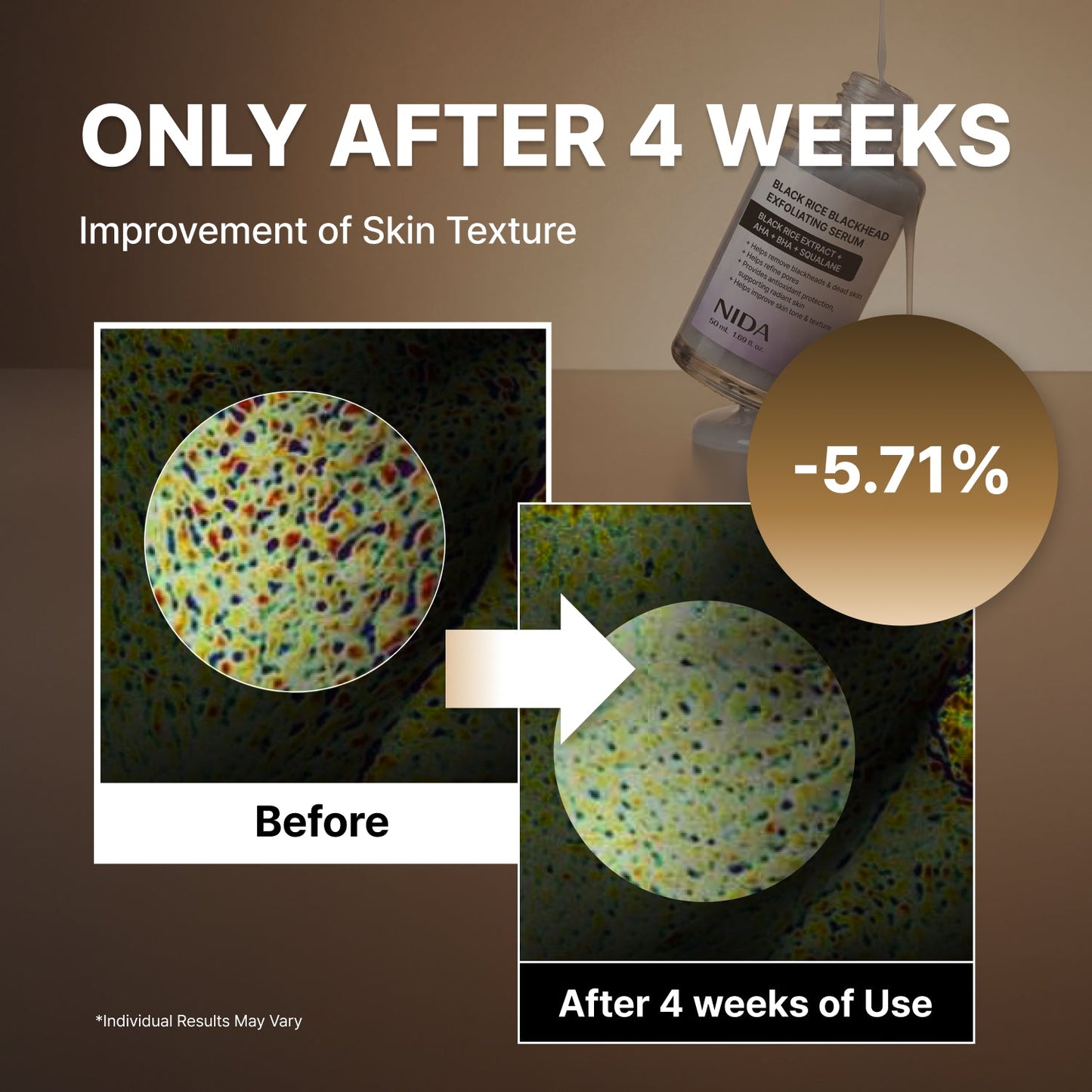 NIDA Black Rice Blackhead Exfoliating Serum