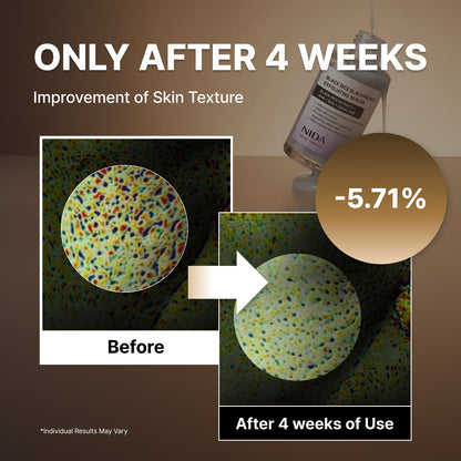 NIDA Black Rice Blackhead Exfoliating Serum