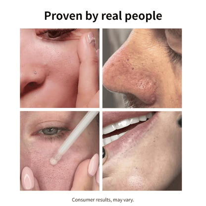 NIDA White Rice Whitehead Exfoliating Serum